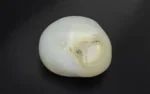 Natural Pearl - 5.85 Carats - Image 3