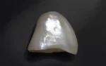 Natural Pearl - 5.27 Carats - Image 3
